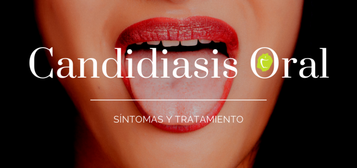 Candidiasis Oral Síntomas Y Tratamiento Clínica Dental Bajo