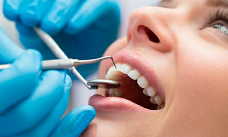 Incrustacion Dental En Que Consiste Clinica Bajo